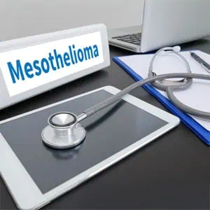 How To Prove Asbestos Exposure In Mesothelioma Lawsuits